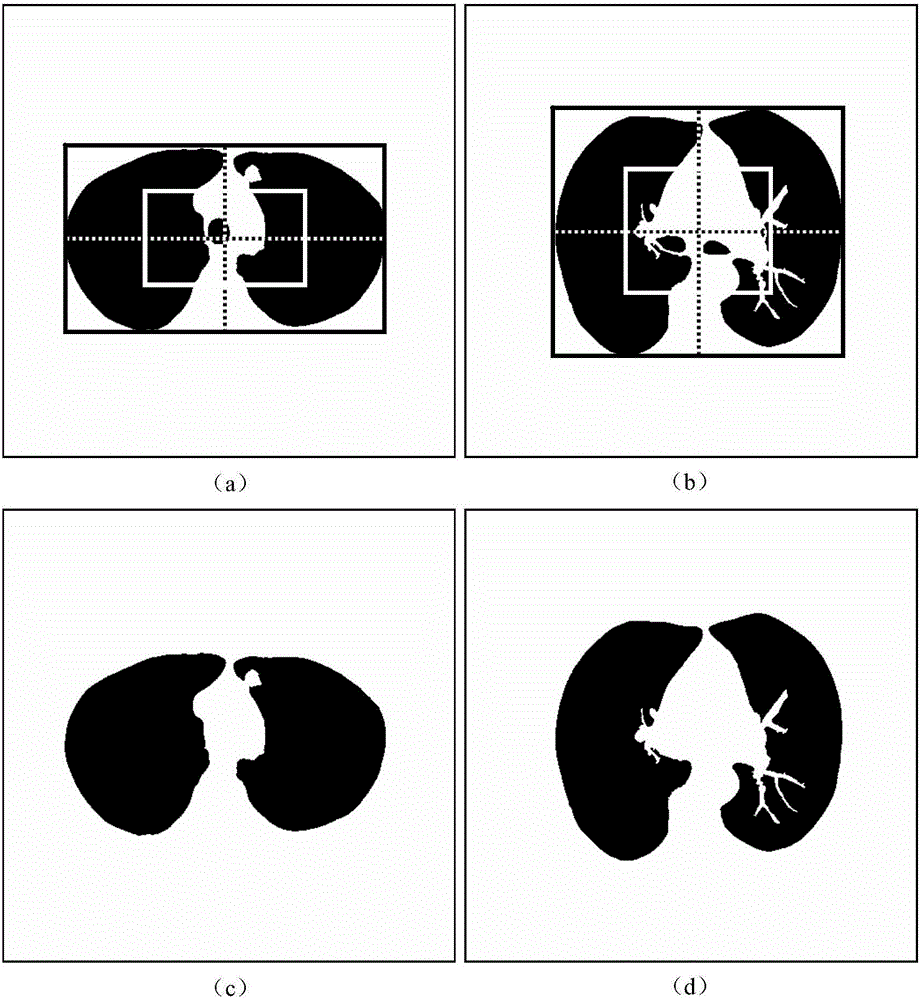 Automatic division method for pulmonary parenchyma of CT image