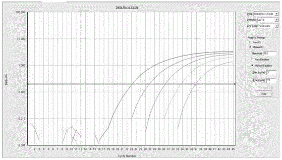 Real-time fluorescent quantitative PCR (polymerase chain reaction) kit for one-step quantitative detection of TRECs gene and its application