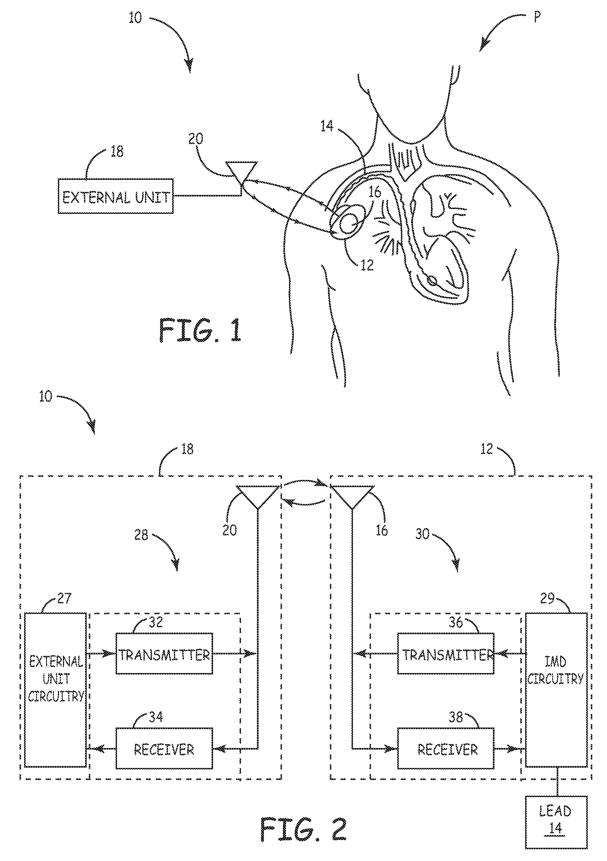System and method for unscheduled wireless communication with a medical device