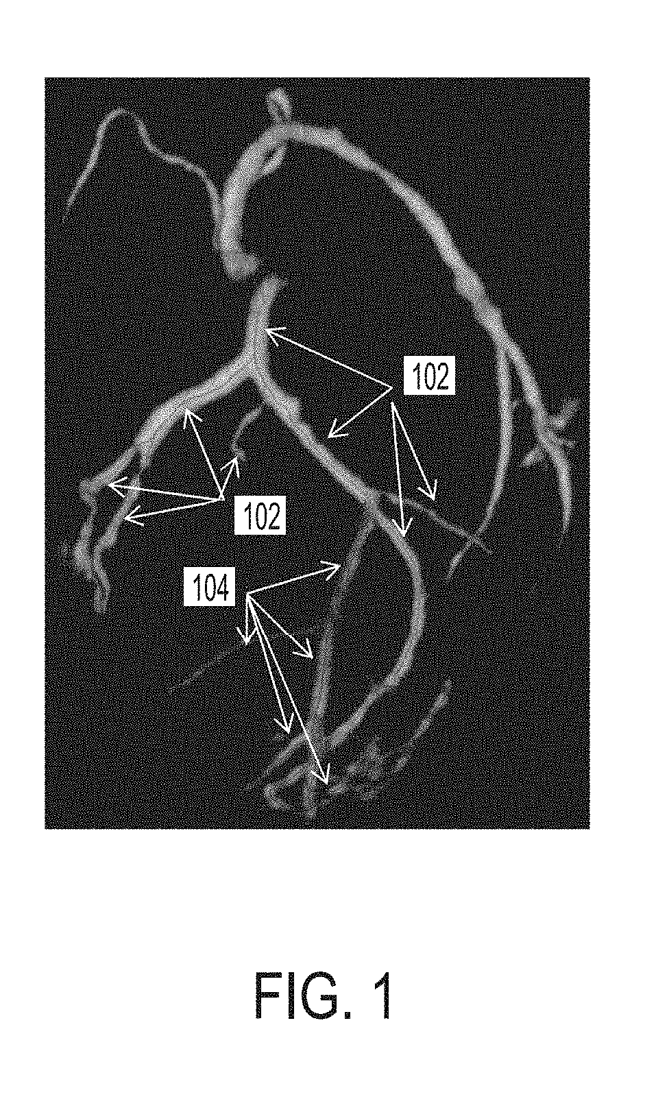 Method and System for Machine Learning Based Classification of Vascular Branches
