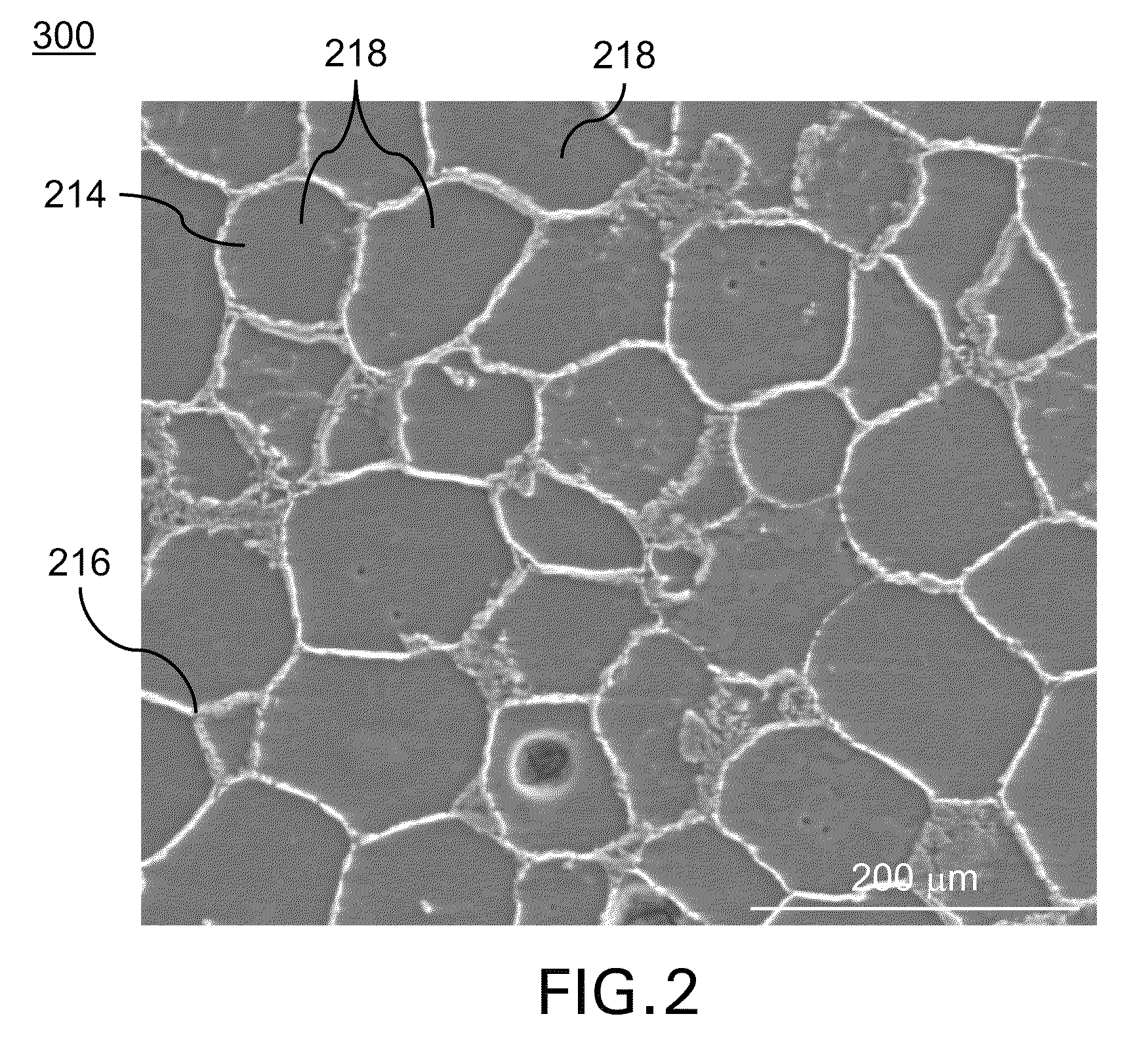 Biodegradable metallic medical implants, method for preparing and use thereof