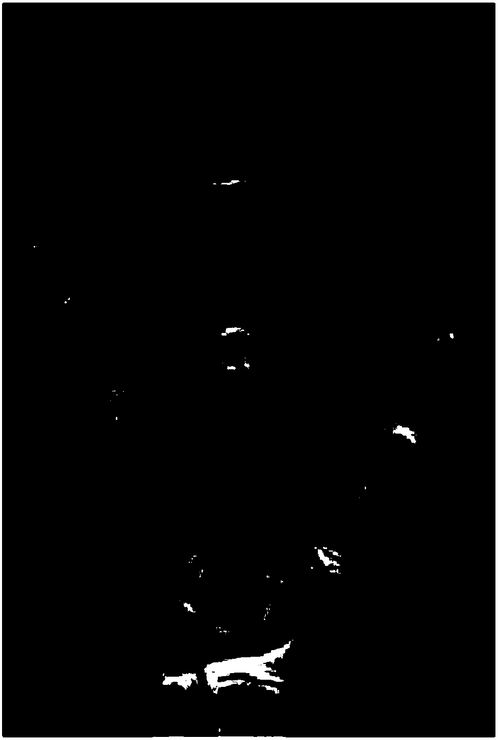 A method and apparatus for detecting bone age