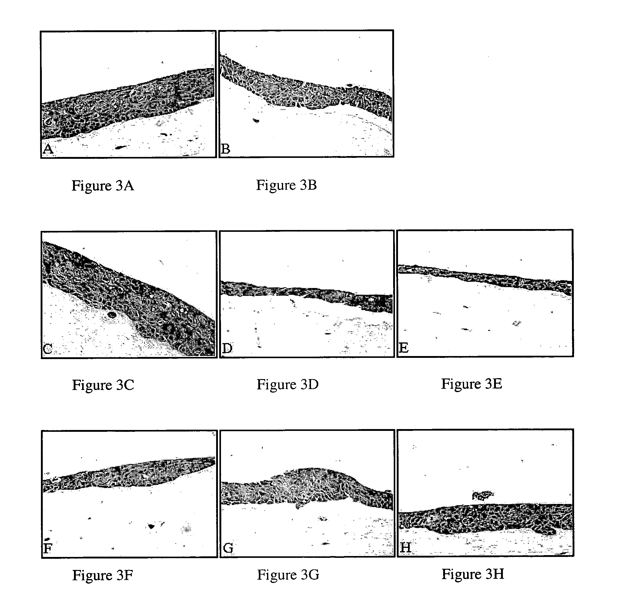 Compositions and methods for inhibiting abnormal cell growth