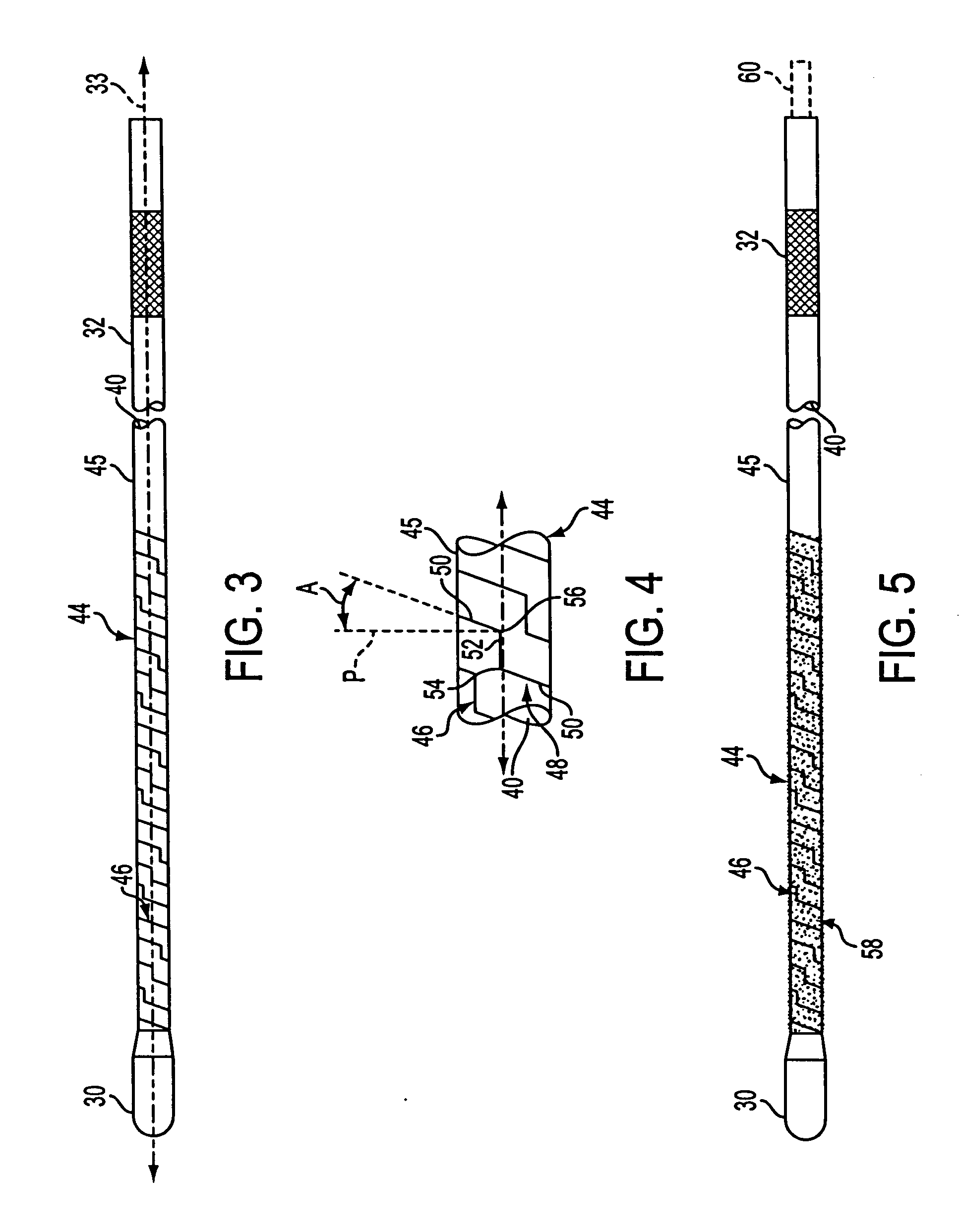 Angled tissue cutting instruments and method of fabricating angled tissue cutting instruments having flexible inner tubular members of tube and sleeve construction