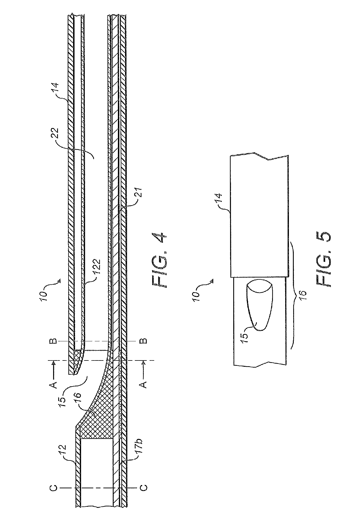 Rapid exchange catheter