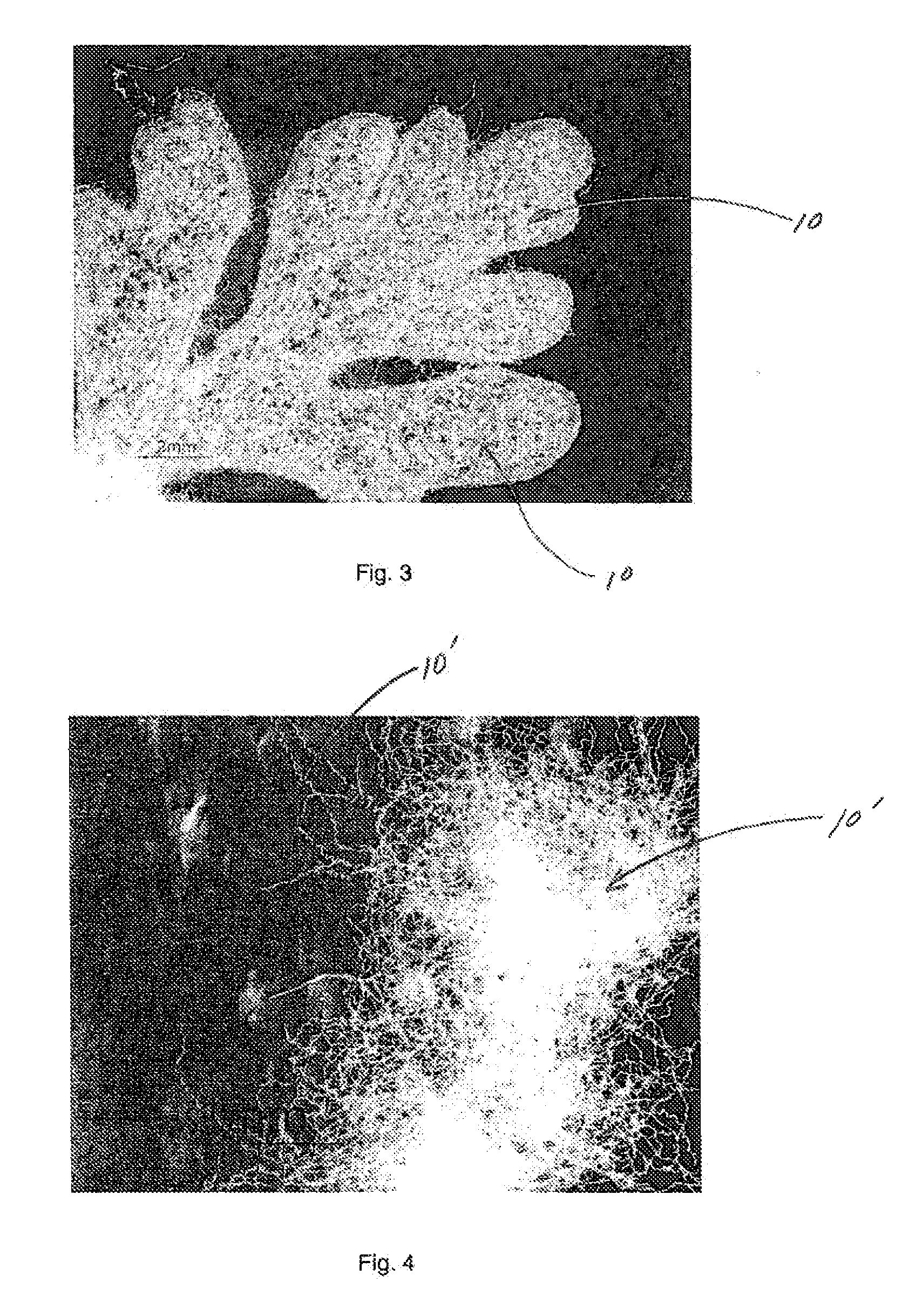Soft and strong fibrous structures and methods for making same