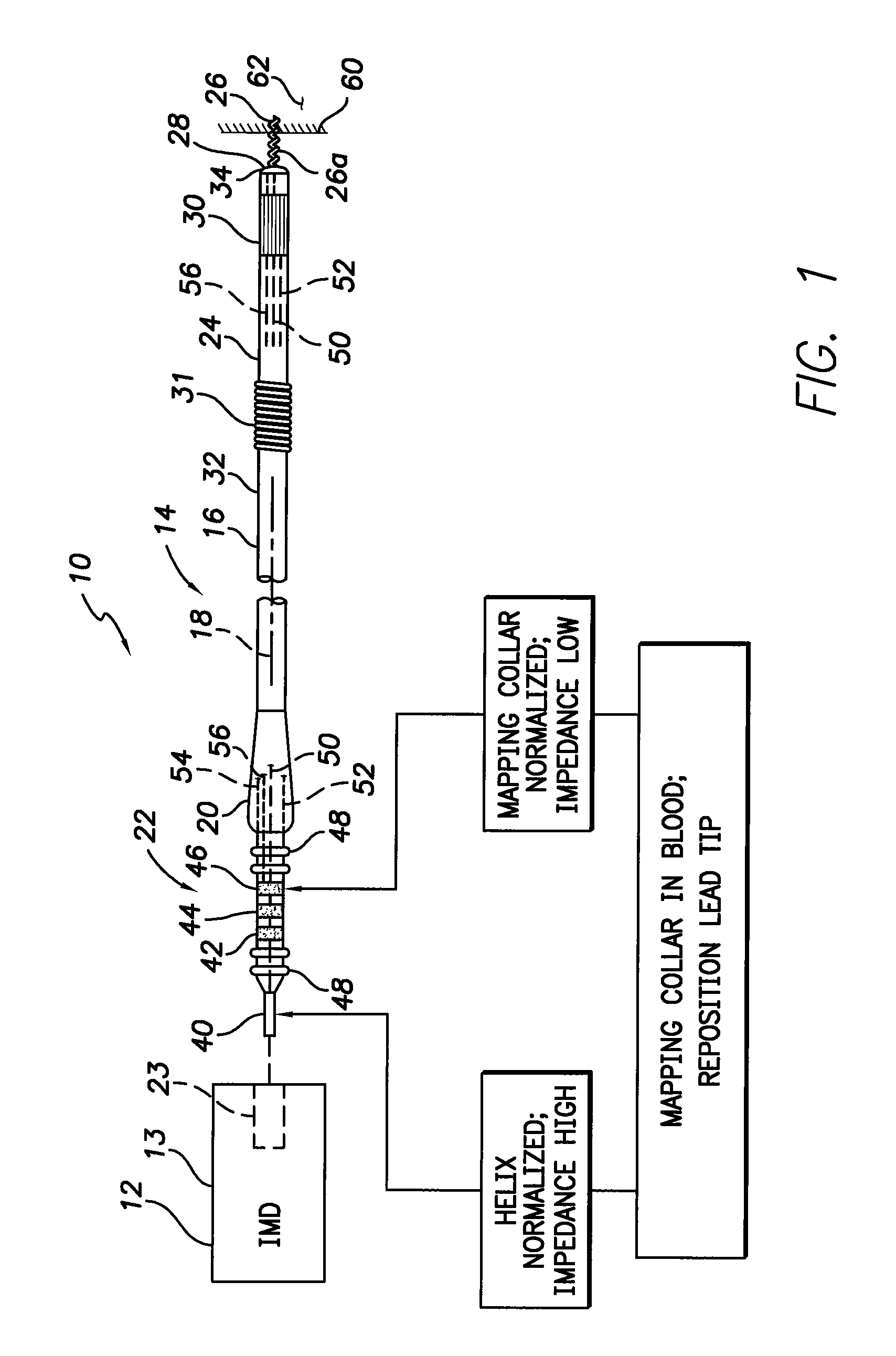 Active fixation medical lead and related method and system