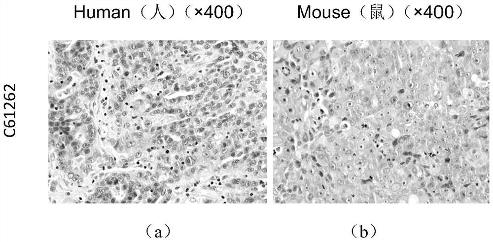 A gastric cancer cell line with high metastatic potential and its establishment method and application