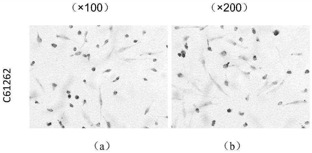 A gastric cancer cell line with high metastatic potential and its establishment method and application