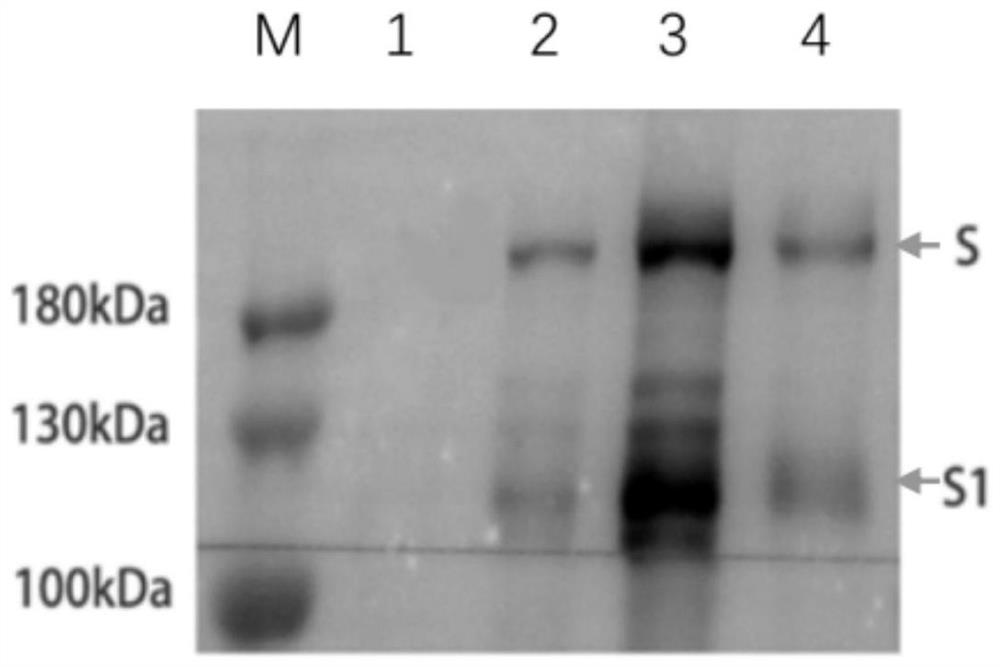 Construction and application of pseudotyped VSV (vesicular stomatitis virus) for expressing SARS-CoV-2 spike (S) protein or variant Sdelta21 of SARS-CoV-2 S protein