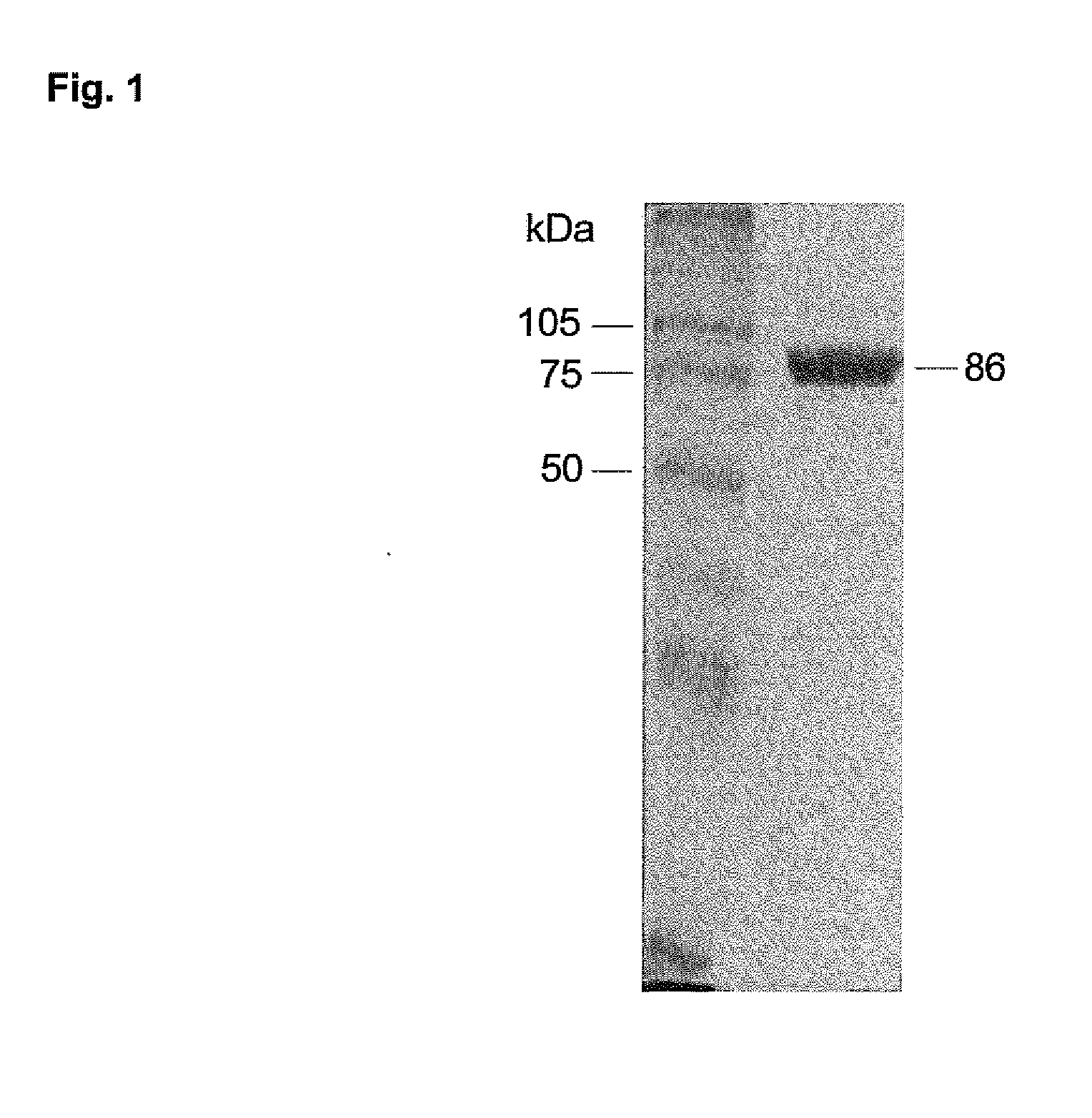 Substances and Methods for the Treatment of Lysosmal Storage Diseases