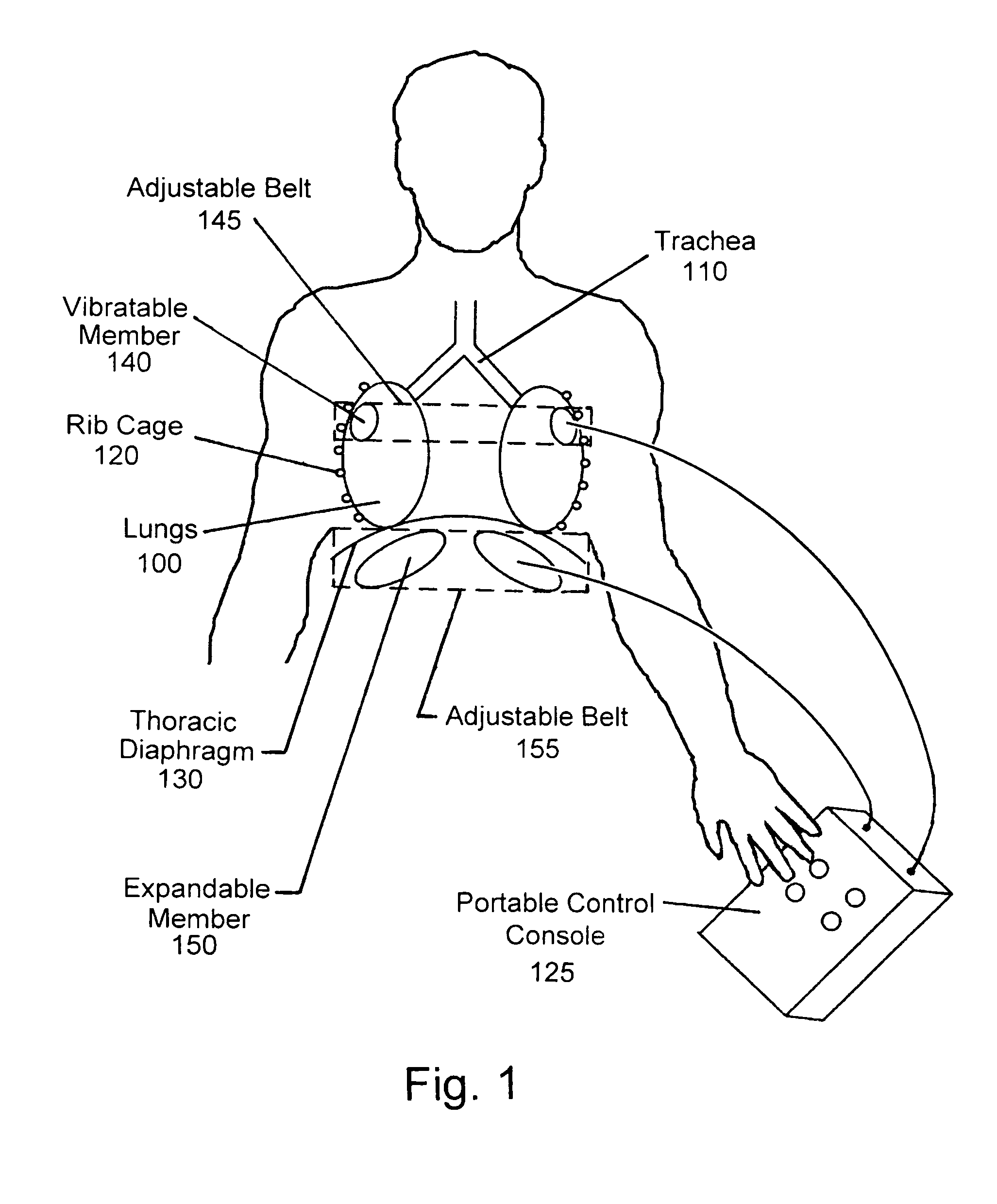 Device for clearing mucus from the pulmonary system