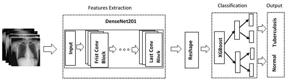 Pulmonary tuberculosis recognition system based on pre-training model