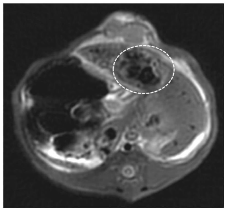 Visual fucoidin embolization microsphere and preparation method thereof