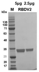 Gene of novel coronavirus B.1.351 South African mutant strain RBD and application of gene