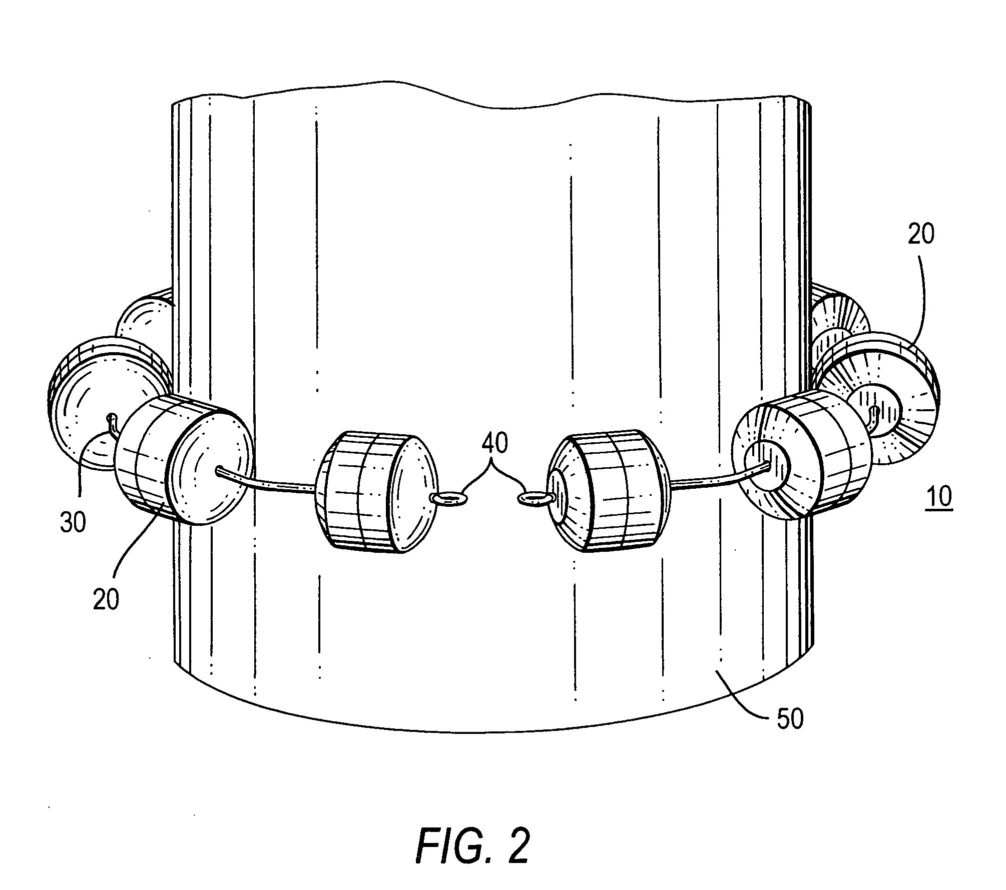Methods and apparatus for treating body tissue sphincters and the like