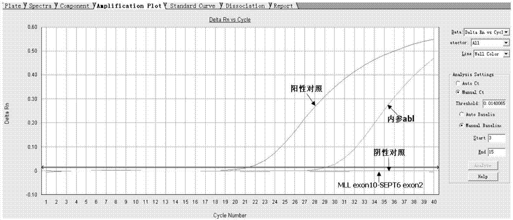 Primer, probe and method for screening MLL-SEPT6 fusion gene of leukemia with real-time fluorescence PCR (polymerase chain reaction) technology