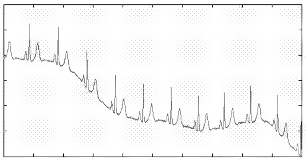 Electrocardiosignal baseline leveling method based on wavelet decomposition and spline interpolation