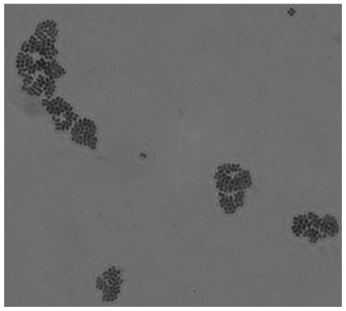 A strain of Pediococcus pentosaceus zf618 and its application