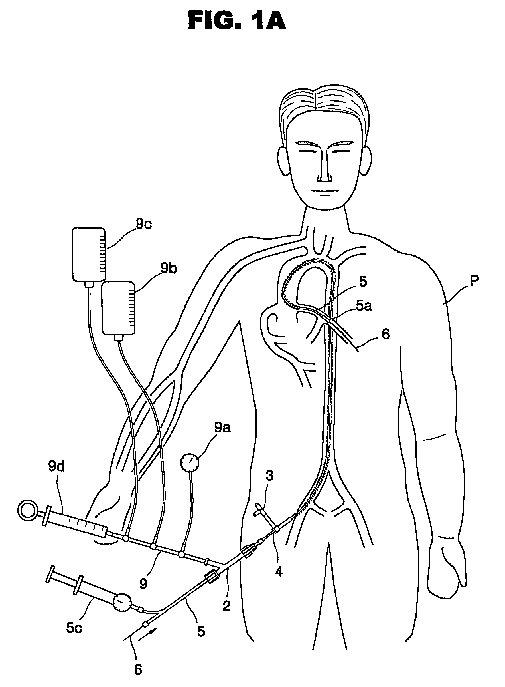 Catheter apparatus for percutaneous coronary intervention capable of accurately positioning stent and balloon in a desired position