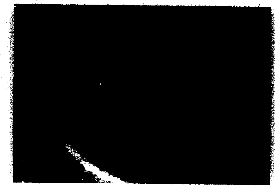 Method for improving resolution of ultrasonic image-forming image, and ultrasonic contrast image-forming apparatus