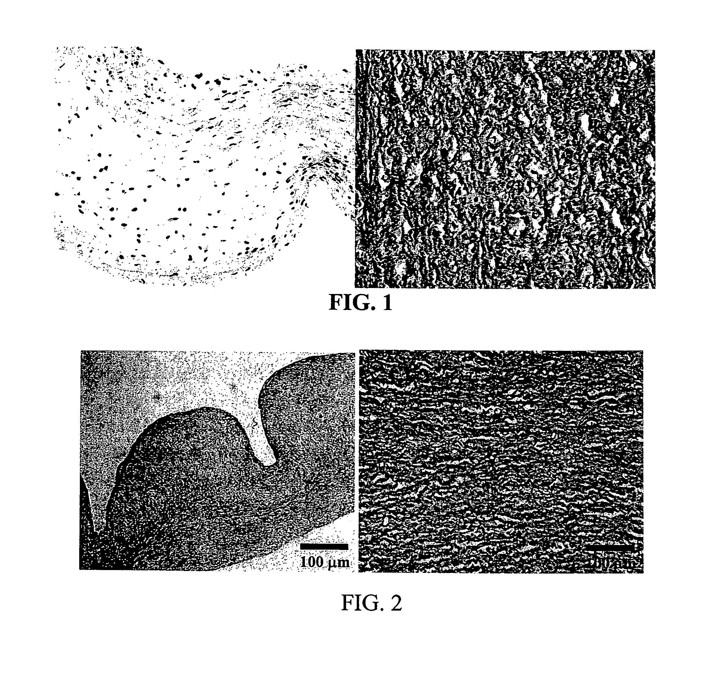 Process for reducing mineralization of tissue used in transplantation