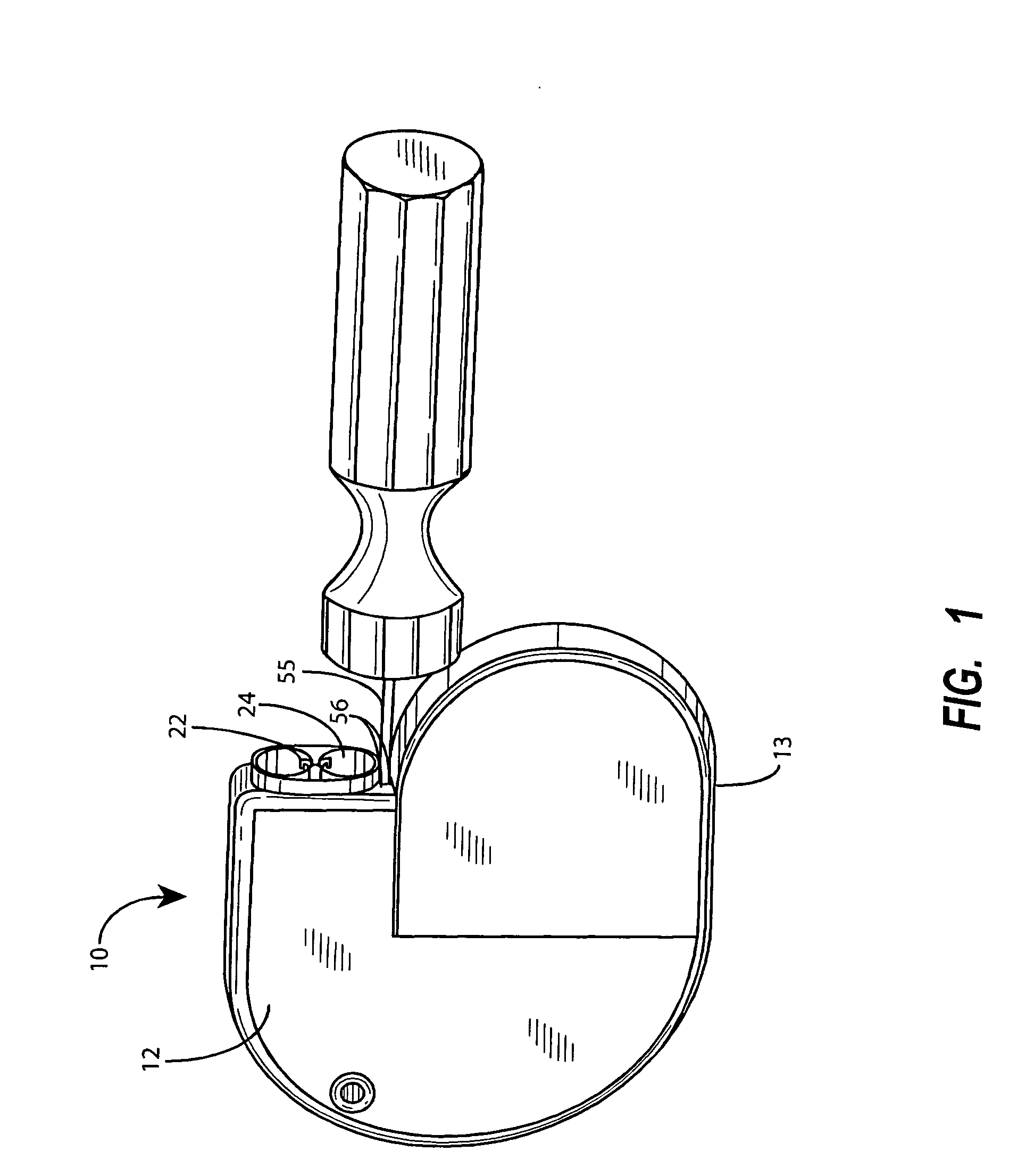 Implantable medical device with detachable battery compartment