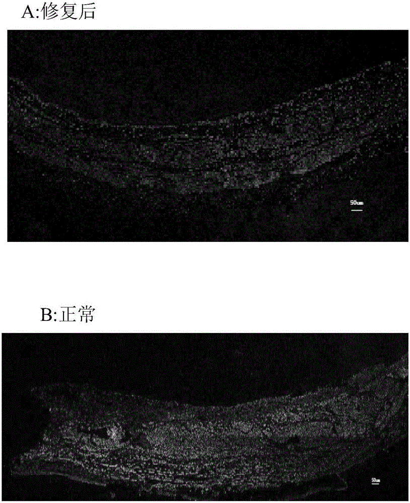 Bladder membrane biological scaffold, preparation method and purpose thereof