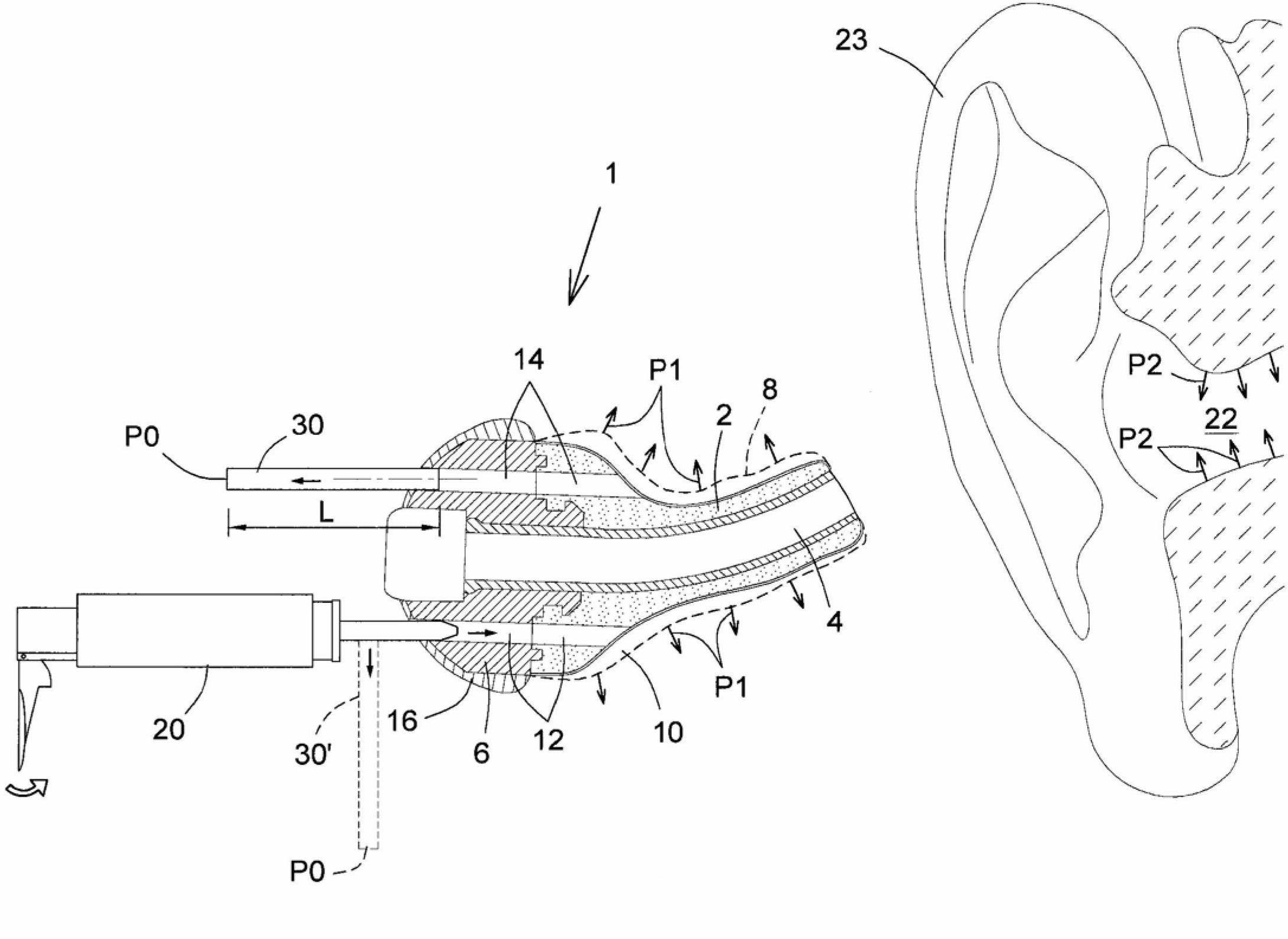 Pressure regulation mechanism for inflatable in-ear device
