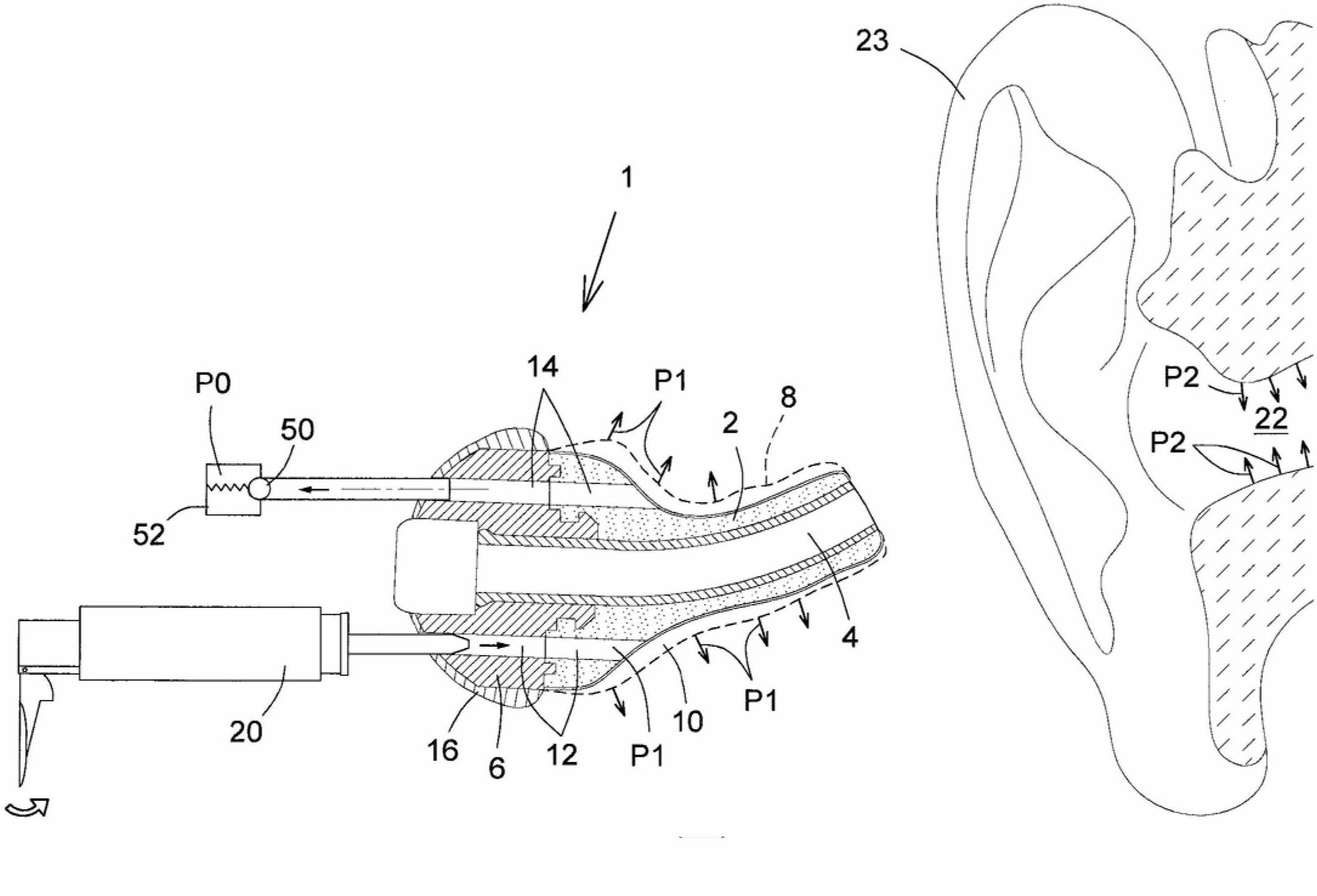 Pressure regulation mechanism for inflatable in-ear device
