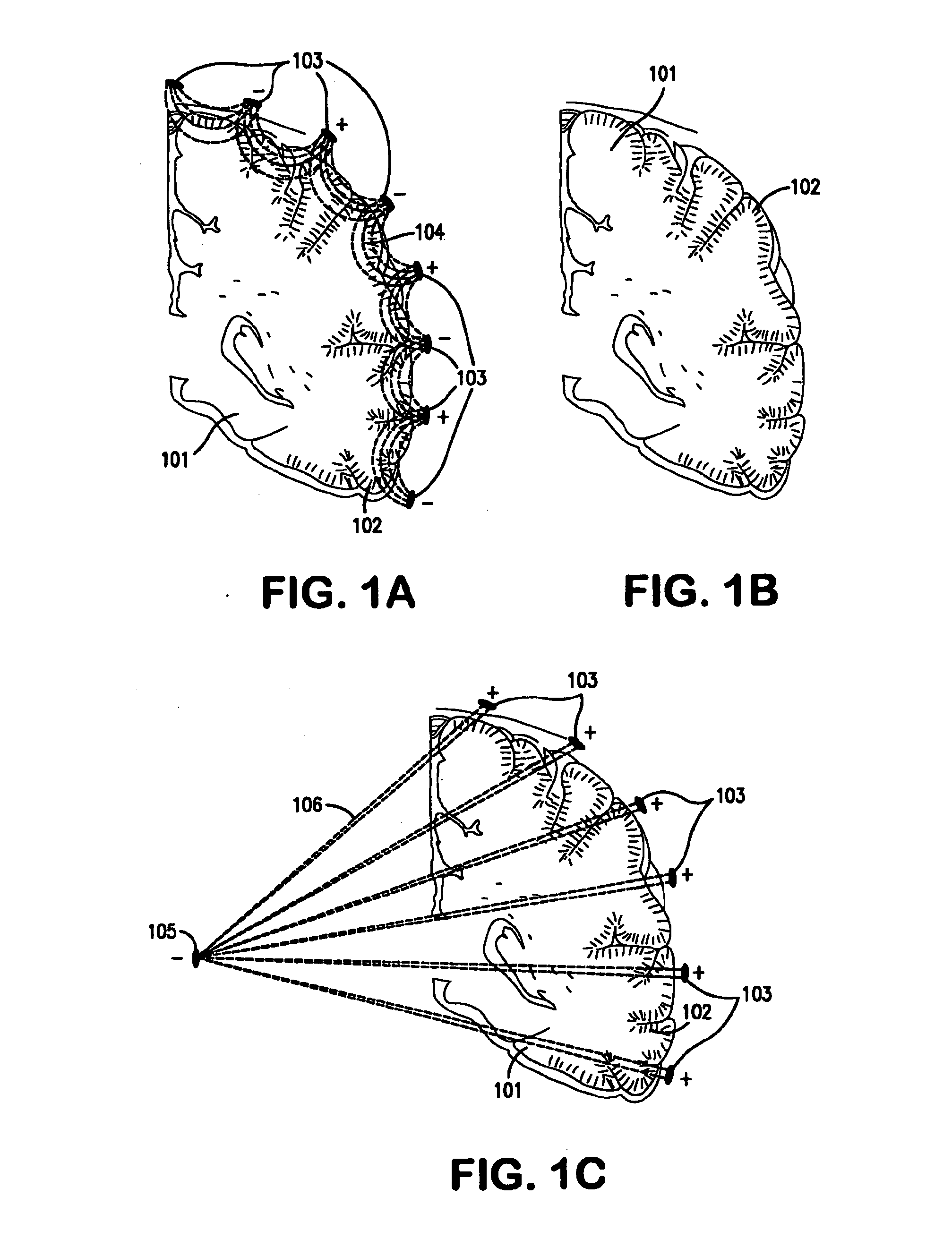Treatment of neurological disorders via electrical stimulation, and methods related thereto
