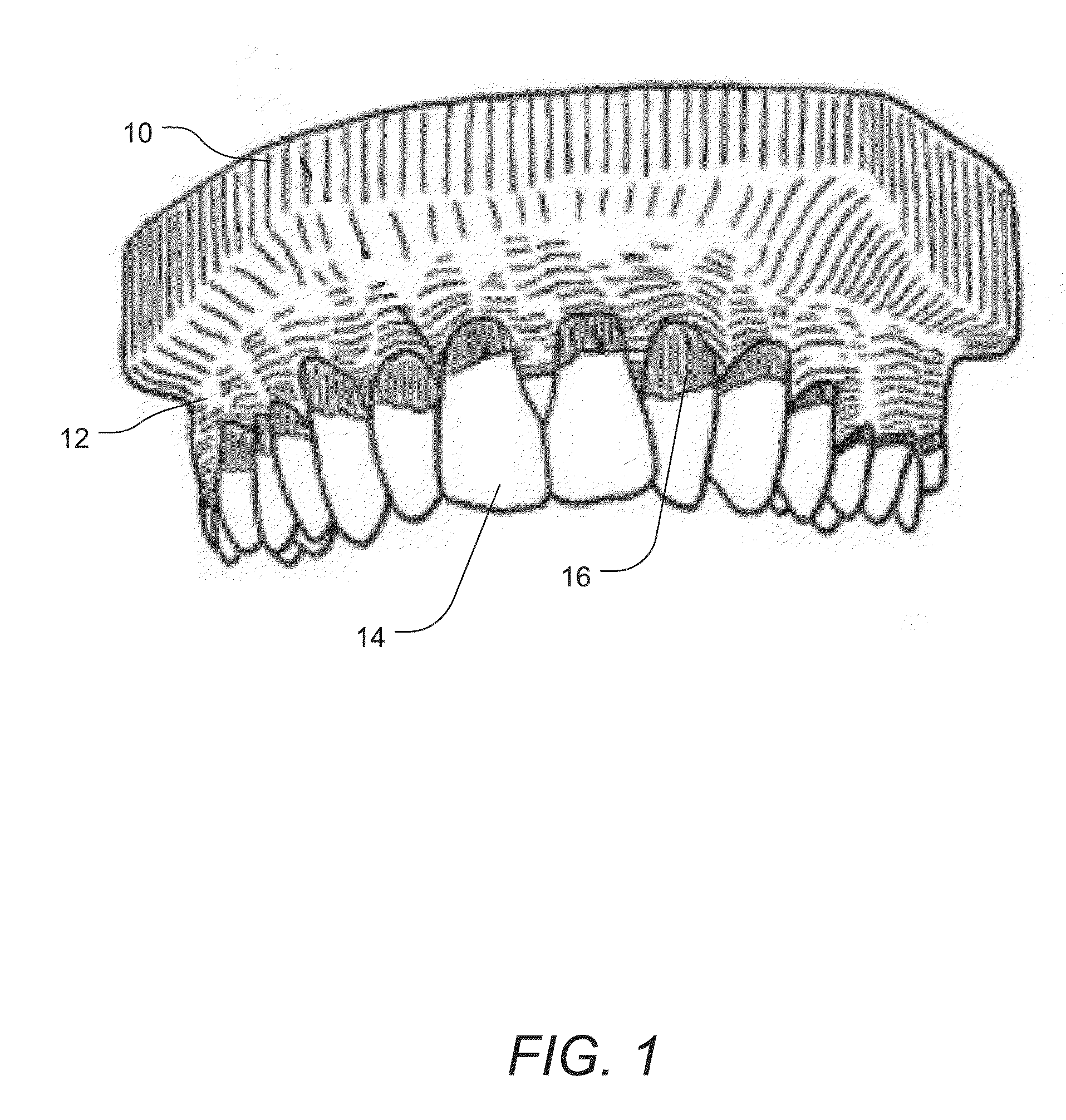 Non-surgical systems and methods for treating receding gums
