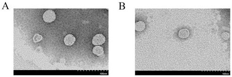 A compound liposome of docetaxel and its preparation method and application