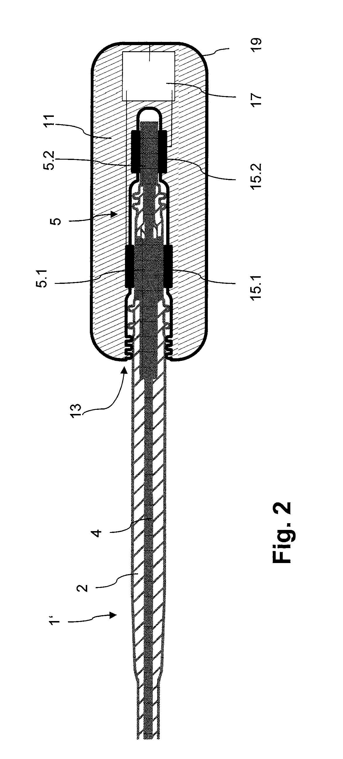 Field decoupling element for use with an implantable line and implantable medical device