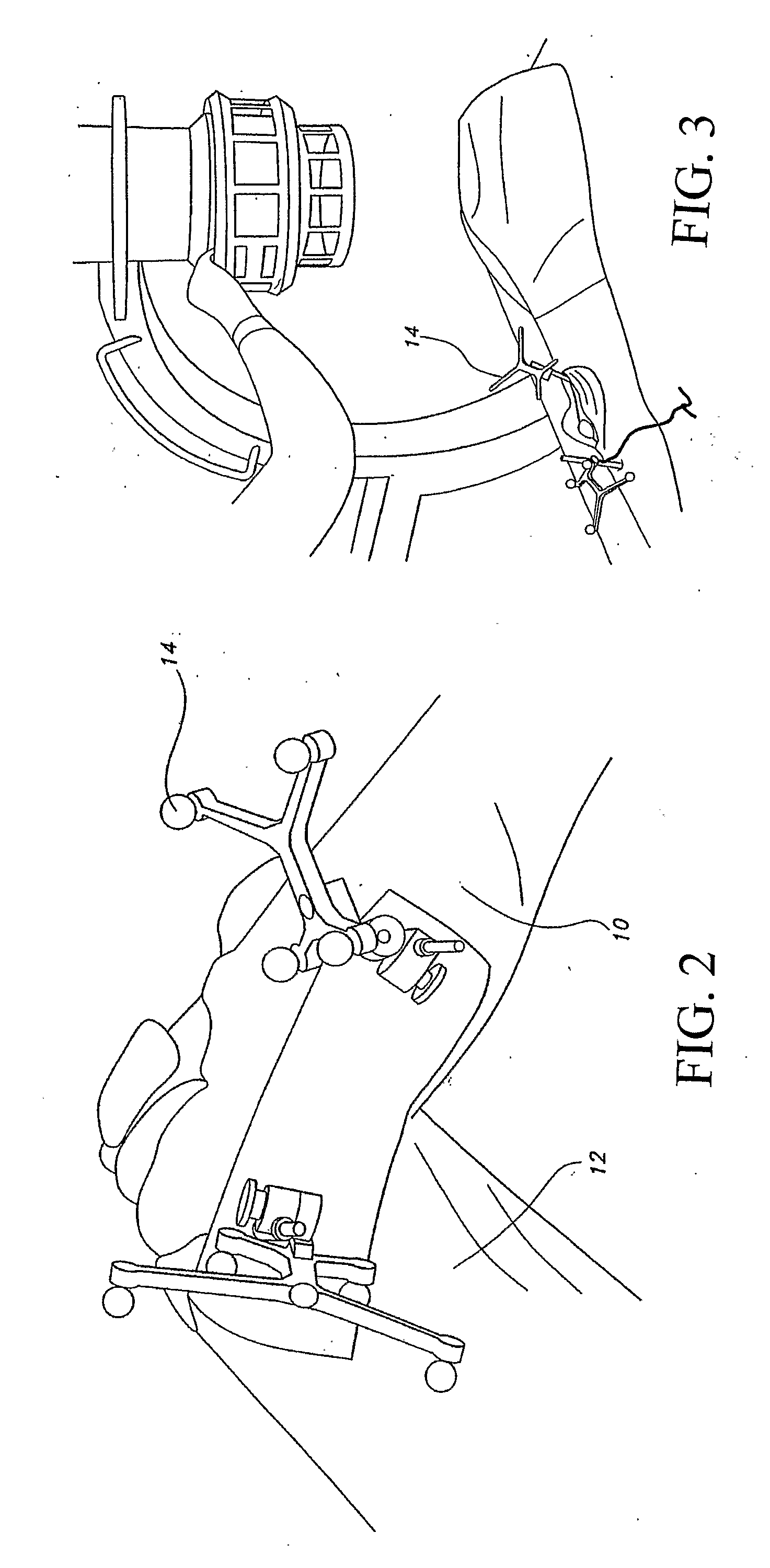 System and Method For Determining Tibial Rotation