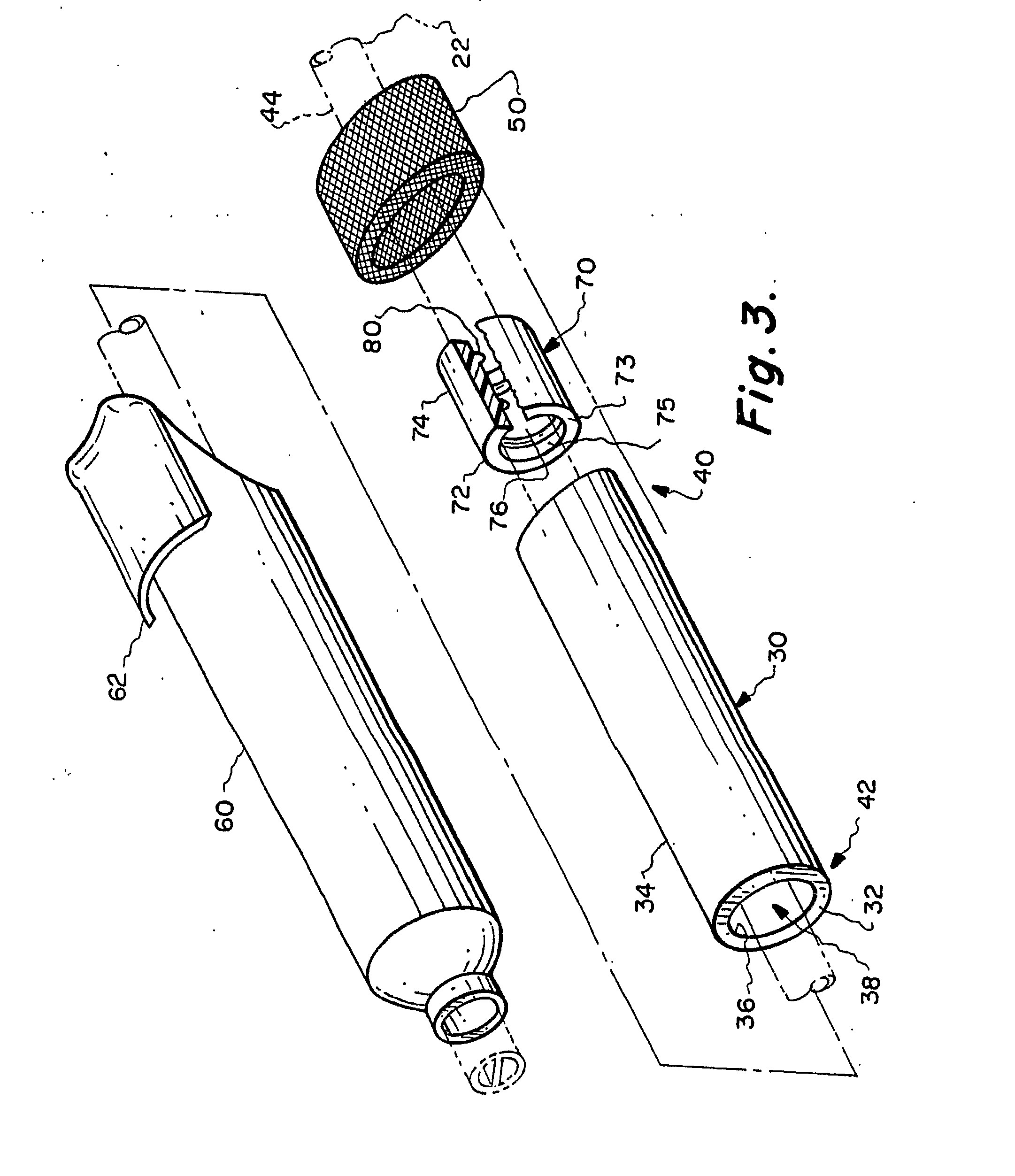 Method and Subcutaneous Apparatus for Facilitating the Replacement of an Implanted Catheter