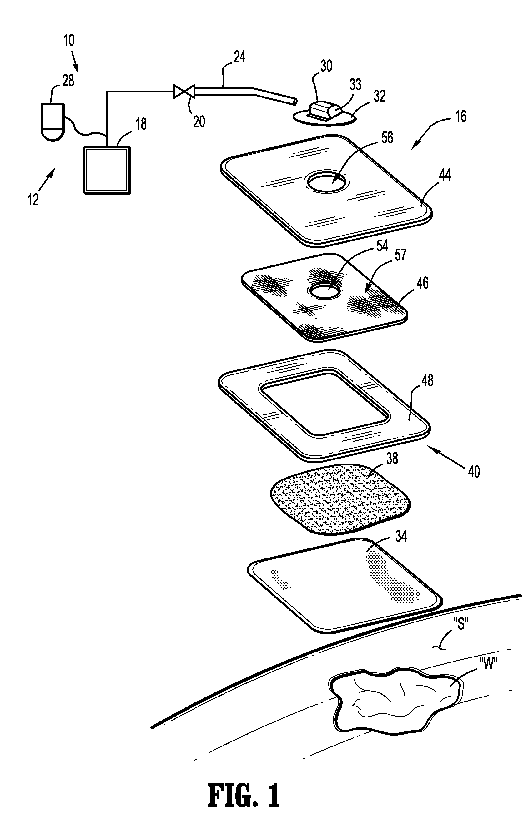 Shear Resistant Wound Dressing for Use in Vacuum Wound Therapy