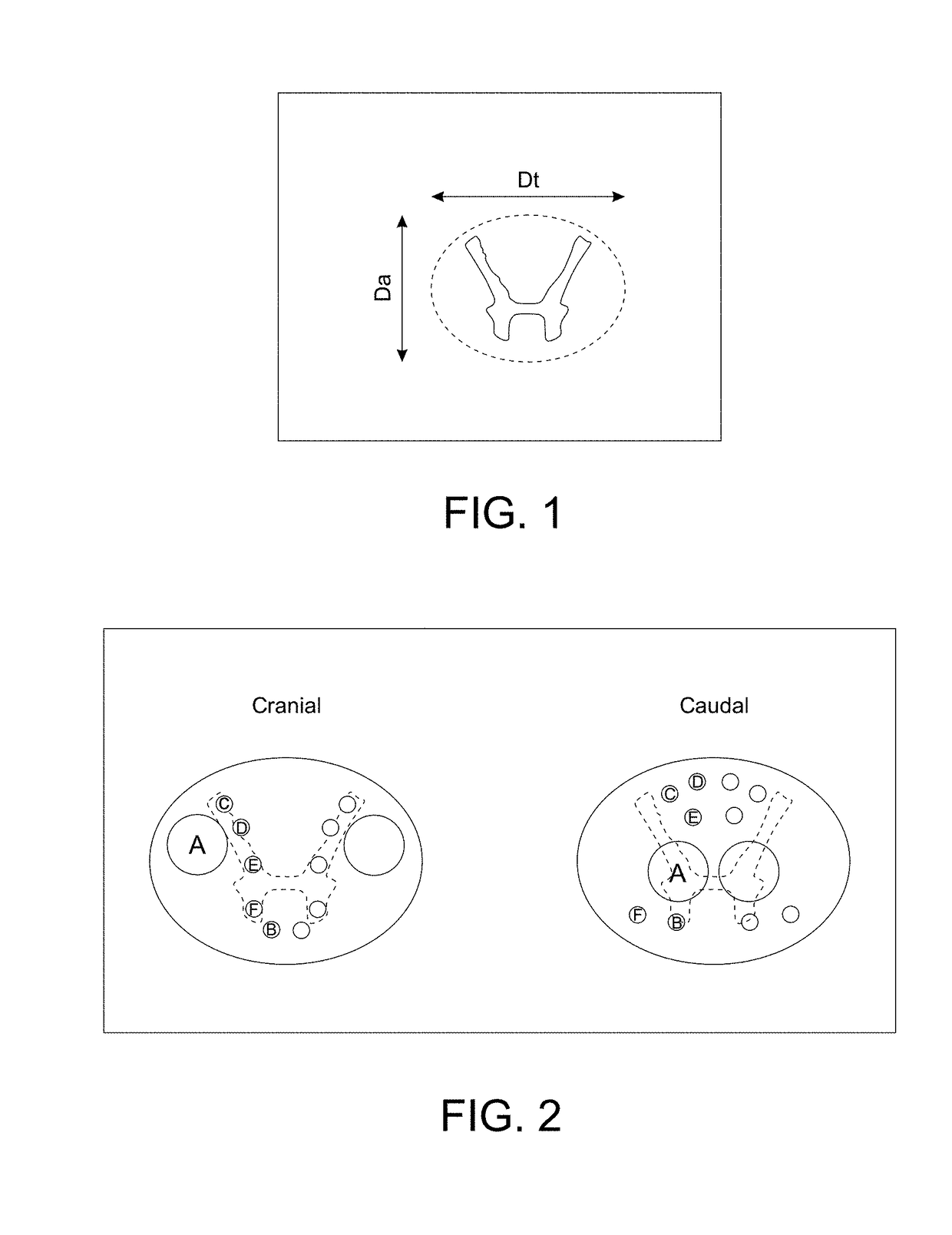 Spinal cord devices and methods for promoting axonal regeneration