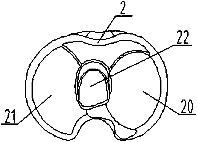 Knee-joint prosthesis for anatomy