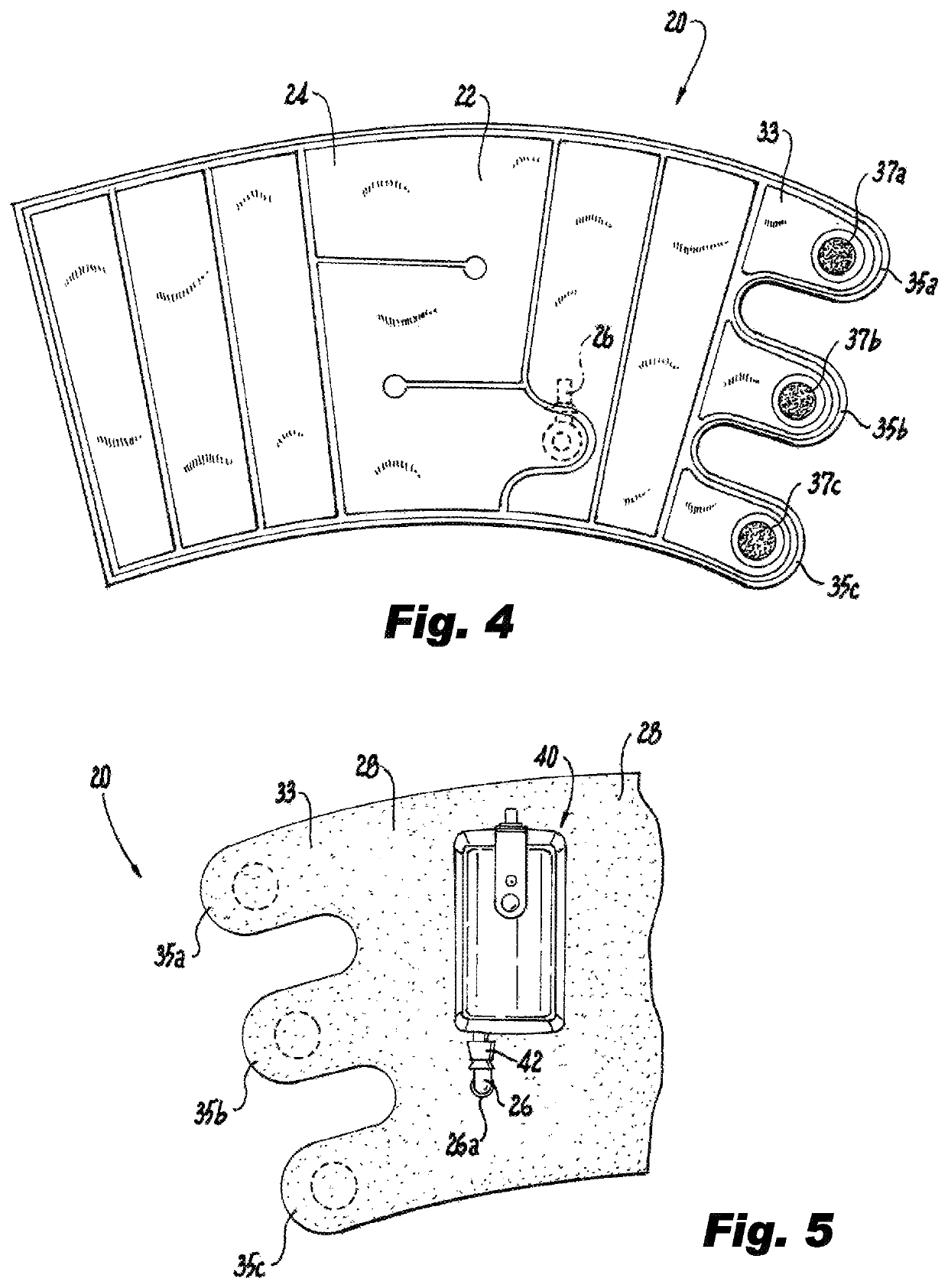 Portable system for the prophylaxis of deep vein thrombosis