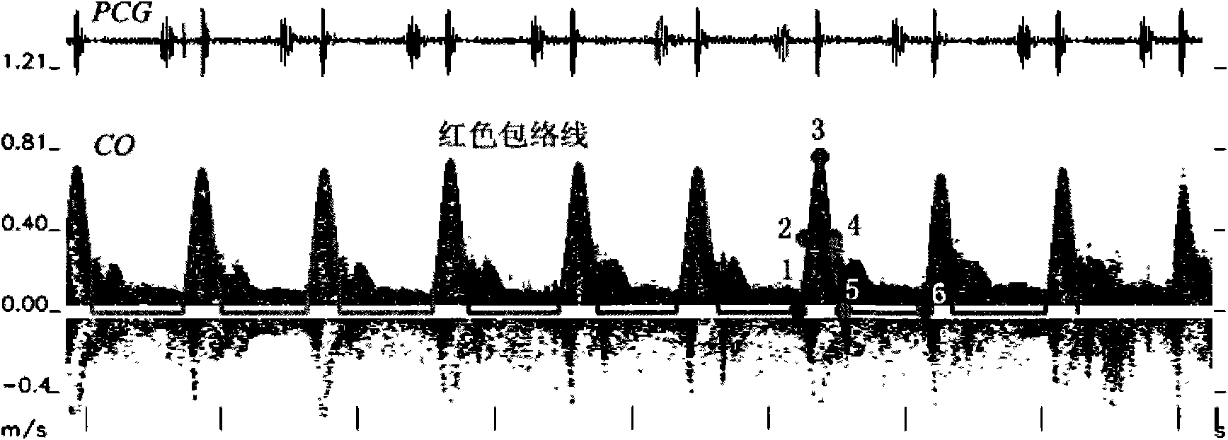Method for recognizing ultrasonic spectrum enveloped peaks by combining cardiac sound
