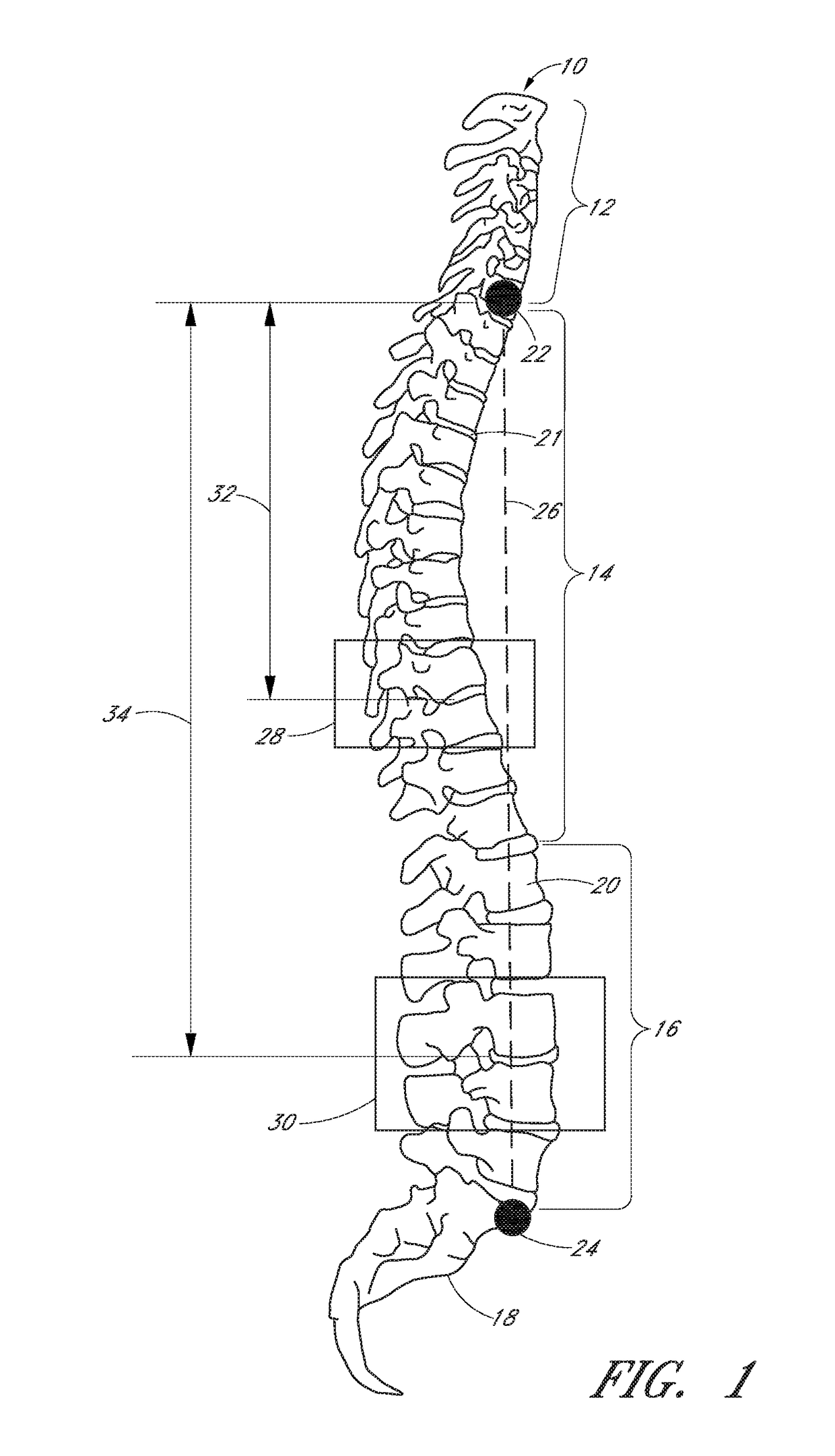 Devices and methods for intra-operative spinal alignment