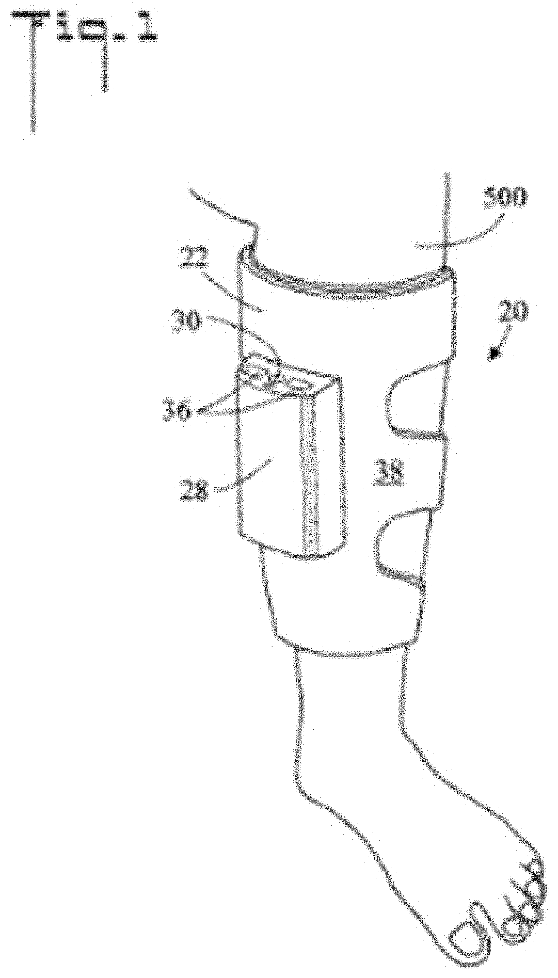 Apparatus for applying periodic pressure to the limb of a patient and method of use