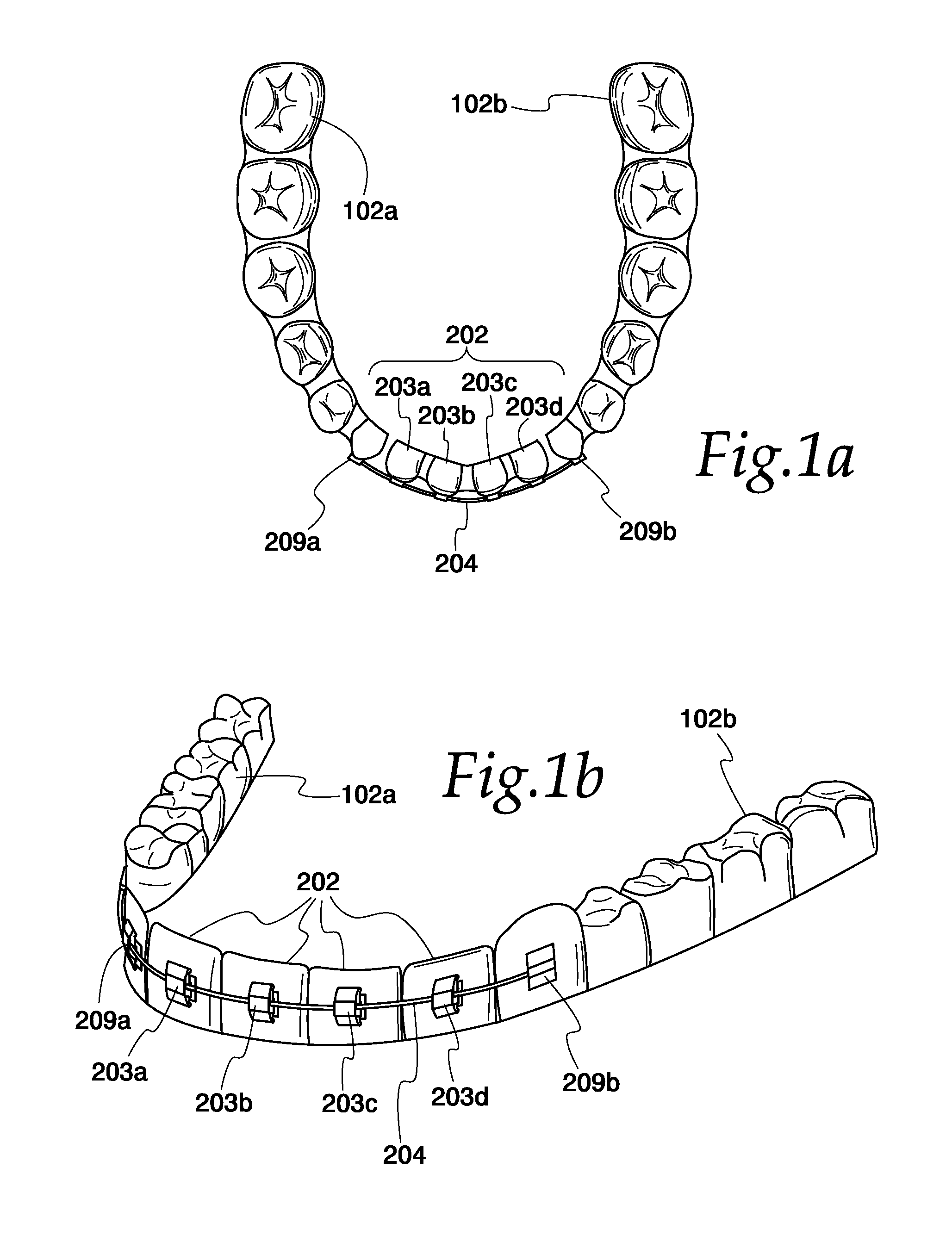 System for moving and aligning teeth