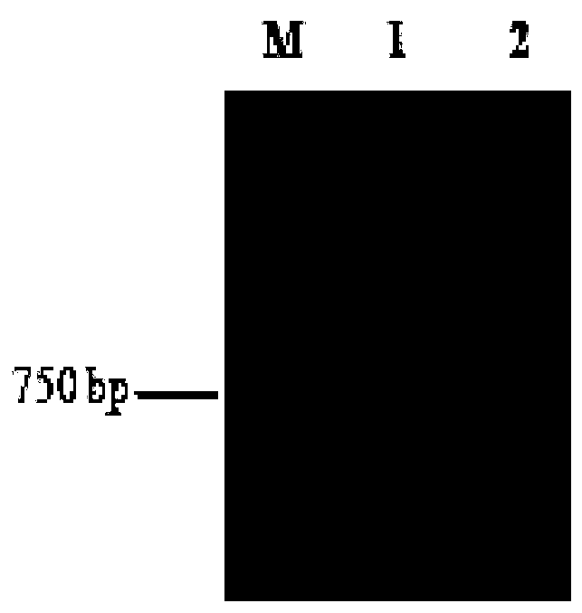 Complement c1inh gene, vector, recombinant strain and protein of grouper oblique and its application