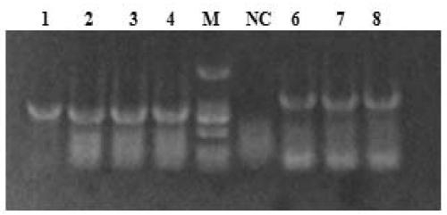 Complement c1inh gene, vector, recombinant strain and protein of grouper oblique and its application