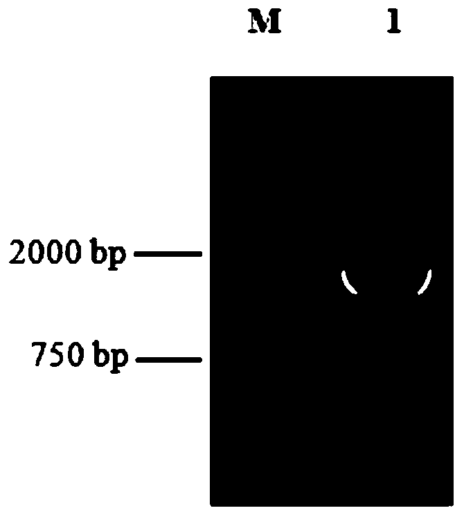 Complement c1inh gene, vector, recombinant strain and protein of grouper oblique and its application