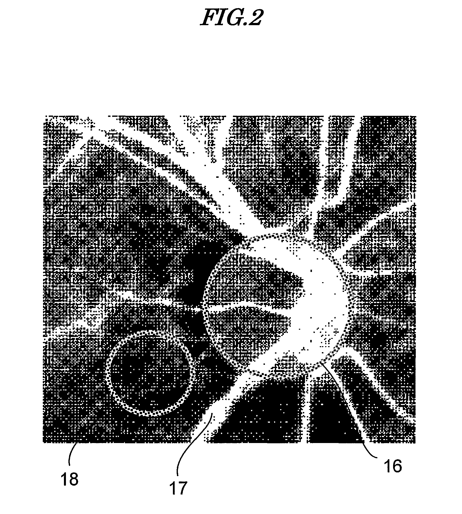 Personal authentication method and personal authentication device utilizing ocular fundus blood flow measurement by laser light