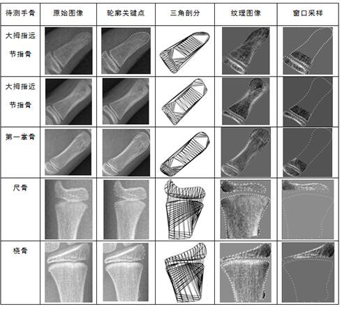 A Texture Feature Extraction Method of Hand Bone X-ray Image for Bone Age Assessment