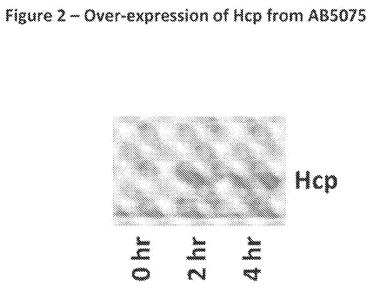 Monoclonal antibodies for treatment of microbial infections